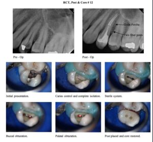 core_restoration