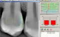 Digital Radiography